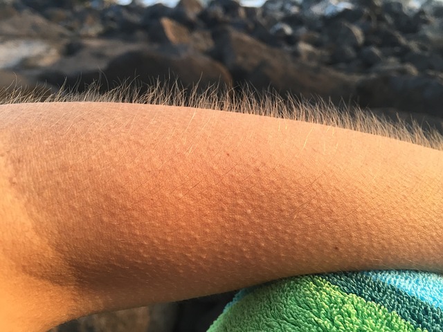 goosebumps 885563 640